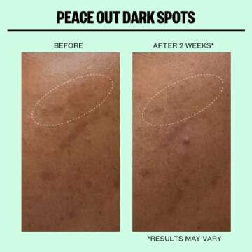 Peace Out Skincare Dark Spots. Dissolving Microstructure Dots to Reduce the Appearance of Dark Spots & Hyperpigmentation, Niacinamide Helps Reveal Clear, Even Skin (12 dots)