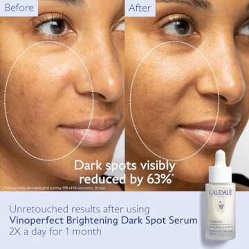 Caudalie Vinoperfect Brightening Dark Spot Serum, 62x More Effective Than Vitamin C