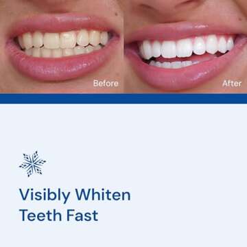 SNOW Diamond Teeth Whitening Strips | Gentle & Enamel Safe White Strips for Teeth Whitening | at-Home Dental Hygiene & Tooth Care for a White Smile Easy Convenient Tooth 42 Ct