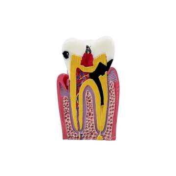 Dental Caries Tooth Model, YOUYA DENTAL Decay Teeth Comparative Study Model 6 Times Caries Tooth Teaching Tools