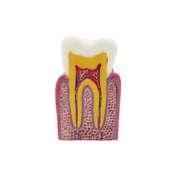 Dental Caries Tooth Model, YOUYA DENTAL Decay Teeth Comparative Study Model 6 Times Caries Tooth Teaching Tools