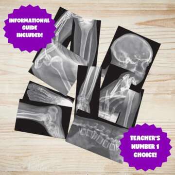 Roylco Broken Bones X-Rays – 15 Realistic Fracture Images for STEM/STEAM Learning, Classroom Anatomy, Health Education, and Labs – Perfect for Teachers, Parents, and Medical Training