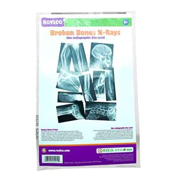 Roylco Broken Bones X-Rays – 15 Realistic Fracture Images for STEM/STEAM Learning, Classroom Anatomy, Health Education, and Labs – Perfect for Teachers, Parents, and Medical Training