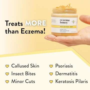 ECZEMA HONEY Original Skin-Soothing Cream - Organic Hand & Body Eczema Relief - Natural Honey Lotion for Dry, Itchy, & Irritable Skin (4 Oz)