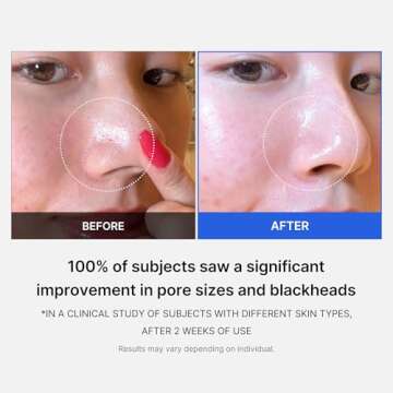 Medicube Zero Pore Pads 2.0 Exfoliating Toner