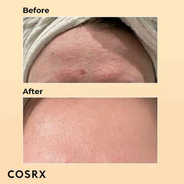 COSRX Snail Mucin Essence for Skin Repair