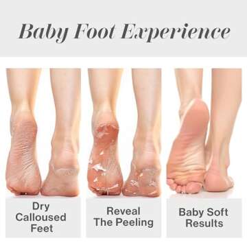 Baby Foot Original Exfoliation Foot Peel - Callus Remover for Rough Cracked, Dry Feet, Dead Skin Removal - Foot Peeling Mask for Baby Soft Feet - Spa Experience at Home & Gift Ideas - Lavender Scented