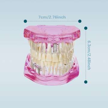 Windplusya Transparent Disease Teeth Model with Dental Implant Bridge, Dental Teach Crown Bridge Removable Model, Tooth Model for Patient and Dental Student Education. (Red)