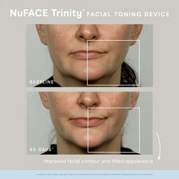 NuFACE Trinity Lip & Eye Set