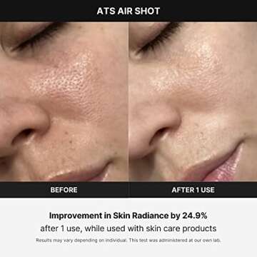 Medicube Age-R ATS Air Shot - Microneedling Skin Care Device for Pore Tightening, Enhanced Absorption, and Smoother Skin Texture - Exfoliation and Skin Rejuvenation - Korean Skincare