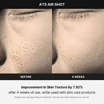 Medicube Age-R ATS Air Shot - Microneedling Skin Care Device for Pore Tightening, Enhanced Absorption, and Smoother Skin Texture - Exfoliation and Skin Rejuvenation - Korean Skincare