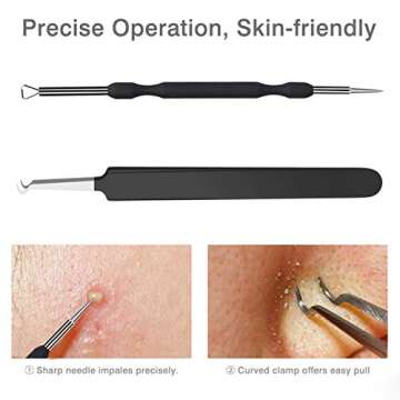 JPNK Blackhead Remover Tool Comedones Extractor Acne Removal Kit for Blemish, Whitehead Popping, 6 Pcs Zit Removing for Nose Face Tools with a Leather Bag (Black)