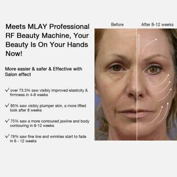 RF Beauty Machine | Skin Tightening