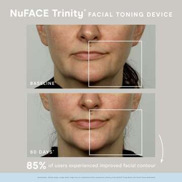 NuFACE Trinity Starter Kit - Facial Toning Device