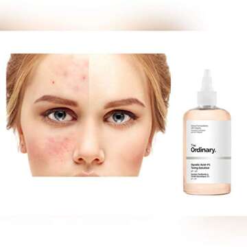 Glycolic Acid 7% Toning Solution for Glowing Skin