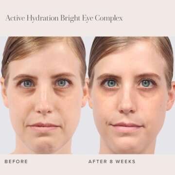 RODAN + FIELDS Active Hydration Bright Eye Complex | 15ml | Moisturizing Under Eye Cream for Dry Skin | Eye Treatment for Refreshed Appearance | Skincare