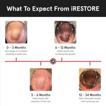 iRestore Essential - Laser Red Light Therapy for Hair Growth - FDA Cleared Hair Loss, Hair Thinning & Alopecia Treatment for Men & Women - Laser Cap for Hair Regrowth Stimulate Denser Fuller Hair