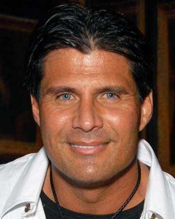 Jose Canseco's 1993 Ligament Transplant Recommendation